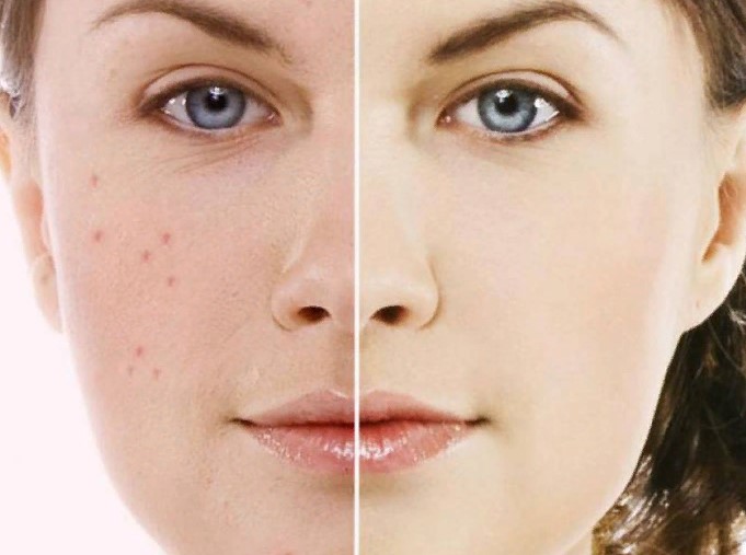 [Alhimik School] Жирная кожа (2019)_0.jpg